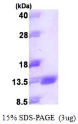 SDS-PAGE Recombinant Human S100 calcium binding protein A14 His Protein