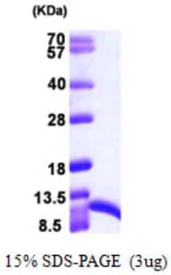 SDS-PAGE Recombinant Human S100A6 His Protein