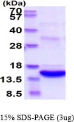 SDS-Page: Recombinant Human S100A8 Protein [NBP2-50570] - 15 % SDS-PAGE (3ug)