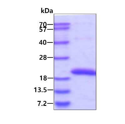 SDS-Page: Recombinant Human SAT2 His Protein [NBP1-99074] - 3ug by SDS-PAGE under reducing condition and visualized by coomassie blue stain.