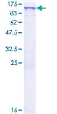 Recombinant Human SCYL2 Protein [H00055681-P01] - 12.5% SDS-PAGE Stained with Coomassie Blue.