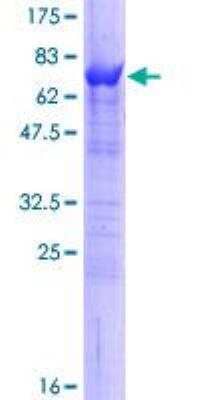 SDS-PAGE Recombinant Human SELENBP1 GST (N-Term) Protein