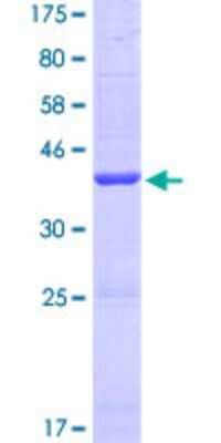 SDS-Page: Recombinant Human SERHL Protein [H00094009-P01] - 12.5% SDS-PAGE Stained with Coomassie Blue.