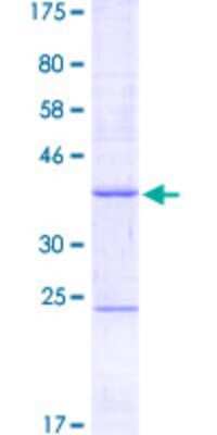 SDS-Page: Recombinant Human SETDB2 Protein [H00083852-Q01] - 12.5% SDS-PAGE Stained with Coomassie Blue.