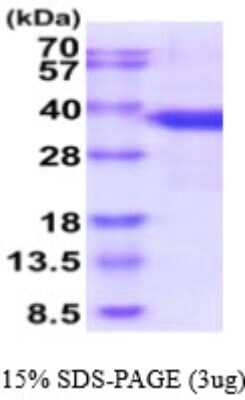 SDS-Page: Recombinant Human SF2 Protein [NBP2-59579] - 15% SDS-PAGE (3ug)