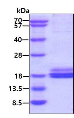 SDS-Page: Recombinant Human SH2D1B Protein [NBP2-60211] - 3ug by SDS-PAGE under reducing condition and visualized by coomassie blue stain