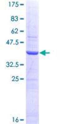 SDS-Page: Recombinant Human SHBG Protein [H00006462-Q01] - 12.5% SDS-PAGE Stained with Coomassie Blue.