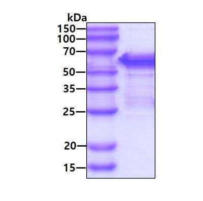 SDS-Page: Recombinant Human SHC1 Protein [NBP1-72374] - 3ug by SDS-PAGE under reducing condition and visualized by coomassie blue stain.