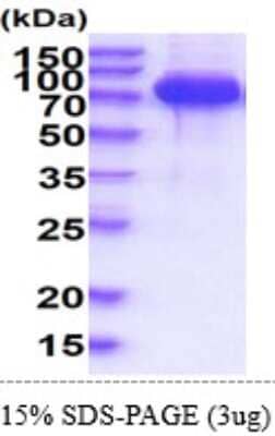 SDS-Page: Recombinant Human SLP-76/LCP2 Protein [NBP2-61206] - 15 % SDS-PAGE (3ug)