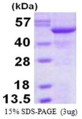 SDS-Page: Recombinant Human SIL1 Protein [NBP1-98949] - 15% SDS-PAGE (3ug)