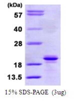 SDS-Page: Recombinant Human SIT1 Protein [NBP1-72451] - 15% SDS-PAGE (3ug)