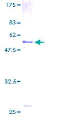 SDS-Page: Recombinant Human SLC25A20 Protein [H00000788-P01] - 12.5% SDS-PAGE Stained with Coomassie Blue.