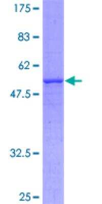 SDS-Page: Recombinant Human SLC25A6 Protein [H00000293-P01] - 12.5% SDS-PAGE Stained with Coomassie Blue.