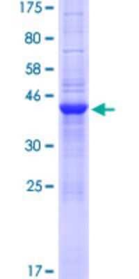 SDS-Page: Recombinant Human SLX1A Protein [H00548593-P01] - 12.5% SDS-PAGE Stained with Coomassie Blue.