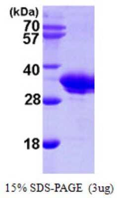 SDS-Page: Recombinant Human SMNDC1 Protein [NBP1-50891] - 15 % SDS-PAGE (3ug)