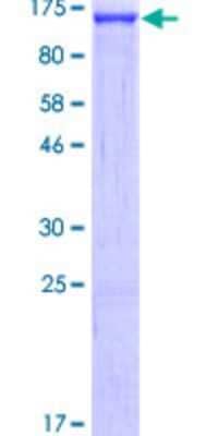 SDS-Page: Recombinant Human SND1 Protein [H00027044-P01] - 12.5% SDS-PAGE Stained with Coomassie Blue.