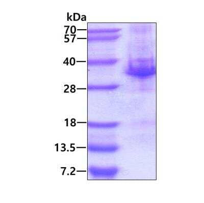 SDS-Page: Recombinant Human SNF8 His Protein [NBP1-98935] - 3ug by SDS-PAGE under reducing condition and visualized by coomassie blue stain.