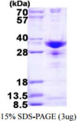 SDS-Page: Recombinant Human SNRPA1 Protein [NBP1-78860] - 15% SDS-PAGE (3ug)