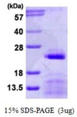SDS-PAGE Recombinant Human SNRPC His Protein