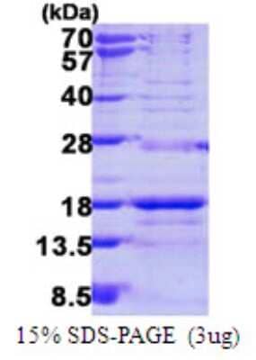 SDS-Page: Recombinant Human SNRPD3 Protein [NBP1-78811] - 15% SDS-PAGE (3ug)