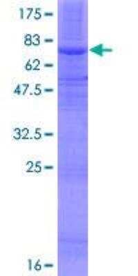 SDS-Page: Recombinant Human SOAT 2 Protein [H00008435-P01] - 12.5% SDS-PAGE Stained with Coomassie Blue.