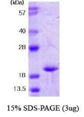 SDS-Page: Recombinant Human SOD1/Cu-Zn SOD Protein [NBC1-18544] - SOD1, 15.9 kDa (154 aa) , confirmed by MALDI-TOF with a purity of 95% by SDS - PAGE