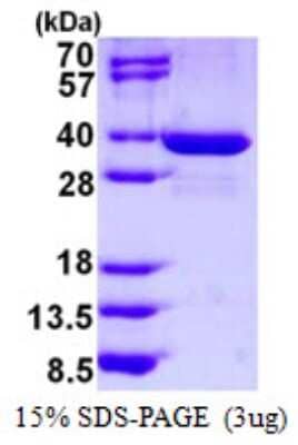 SDS-PAGE Recombinant Human SPIN1 His Protein