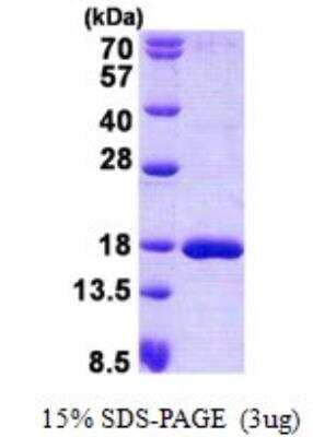 SDS-Page: Recombinant Human SSBP1 Protein [NBP2-22805]