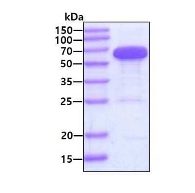 SDS-PAGE Recombinant Human STI1 His Protein