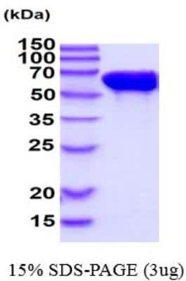 SDS-PAGE Recombinant Human STI1 Protein