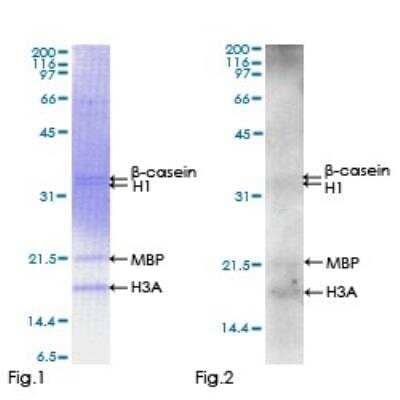 Functional: Recombinant Human STK22C Protein [H00081629-P01]