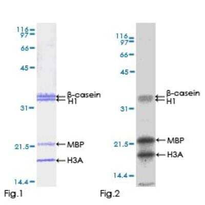 Functional: Recombinant Human STK33 Protein [H00065975-P01]