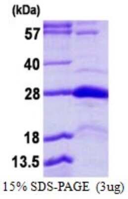 SDS-Page: Recombinant Human STYX Protein [NBP1-99069] - 15% SDS-PAGE (3ug)