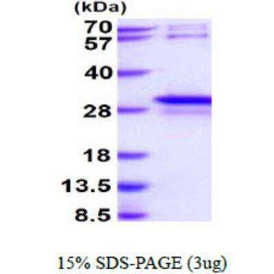 SDS-Page: Recombinant Human STYX Protein [NBP1-99076] - 3ug by SDS-PAGE under reducing condition and visualized by coomassie blue stain