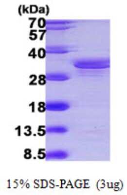 SDS-PAGE Recombinant Human SUGT1 His Protein