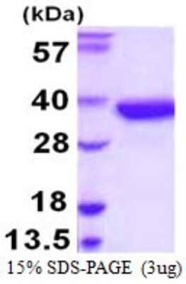 SDS-PAGE Recombinant Human SULT1A2 His Protein