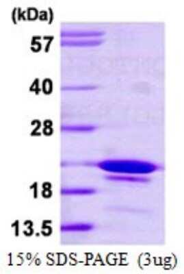 SDS-PAGE Recombinant Human SYF2 His Protein