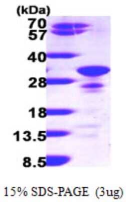 SDS-Page: Recombinant Human Secretogranin V Protein [NBP1-48343] - 15 % SDS-PAGE (3ug)