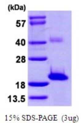 SDS-PAGE Recombinant Human Sentan His Protein