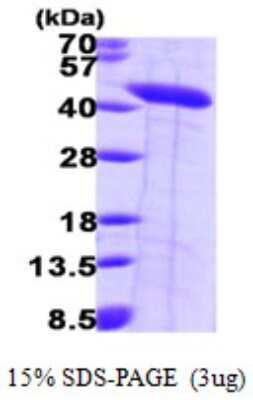 SDS-PAGE Recombinant Human Septin-2 His Protein