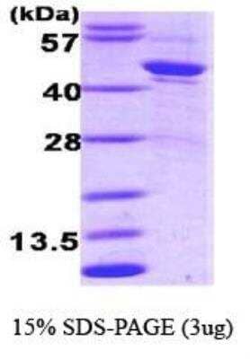 SDS-Page: Recombinant Human Serpin A1/alpha 1-Antitrypsin Protein [NBC1-18549] - Antitrypsin, 44.4 kDa (395 aa), confirmed by MALDI-TOF with a purity of 90% by SDS - PAGE