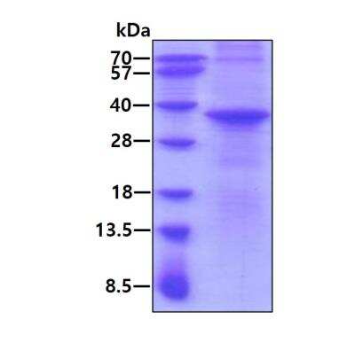 SDS-Page: Recombinant Human Sertad1 Protein [NBP1-98894] - 3ug by SDS-PAGE under reducing condition and visualized by coomassie blue stain.