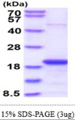 SDS-Page: Recombinant Human Skp1 Protein [NBP1-30173] - 15% SDS-Page (3ug)