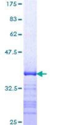 SDS-Page: Recombinant Human Smad7 Protein [H00004092-Q01] - 12.5% SDS-PAGE Stained with Coomassie Blue