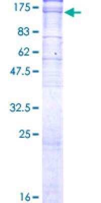 SDS-Page: Recombinant Human Sodium Potassium ATPase Alpha 3 Protein [H00000478-P01] - 12.5% SDS-PAGE Stained with Coomassie Blue.