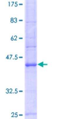 SDS-Page: Recombinant Human Sodium Potassium ATPase Alpha 3 Protein [H00000478-Q01] - 12.5% SDS-PAGE Stained with Coomassie Blue.