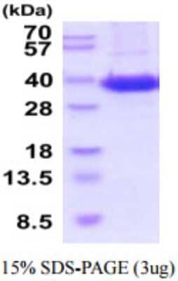 SDS-Page: Recombinant Human Sodium Potassium ATPase Beta 1 Protein [NBP2-59894] - 15% SDS-PAGE