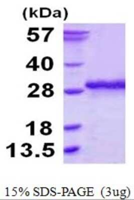 SDS-Page: Recombinant Human Ssu72 Protein [NBP1-78900] - 15% SDS-PAGE (3ug)