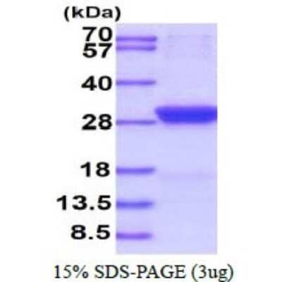 SDS-Page: Recombinant Human StAR Protein [NBP1-72531] - 15% SDS-PAGE (3ug)