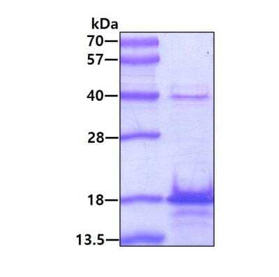 SDS-Page: Recombinant Human Stathmin-2/STMN2 Protein [NBP1-30285] - 3ug by SDS-PAGE under reducing condition and visualized by coomassie blue stain.